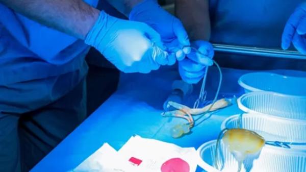 Penis Büyültme Ameliyatı İzmir