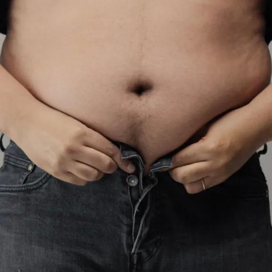 Pubektomi ve Pubik Liposuction